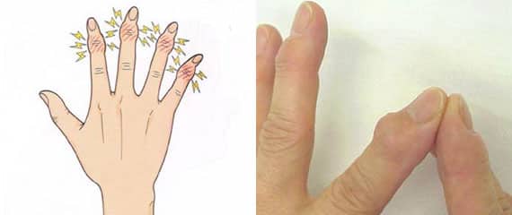 手指の第一関節の痛みと腫れ。押すと痛いし熱感も。これは何の病気？